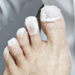 Toes covered with soaked cotton